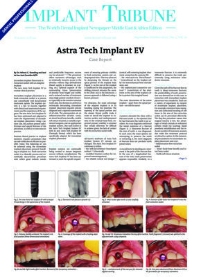 Implant Tribune Middle East & Africa No.5, 2020