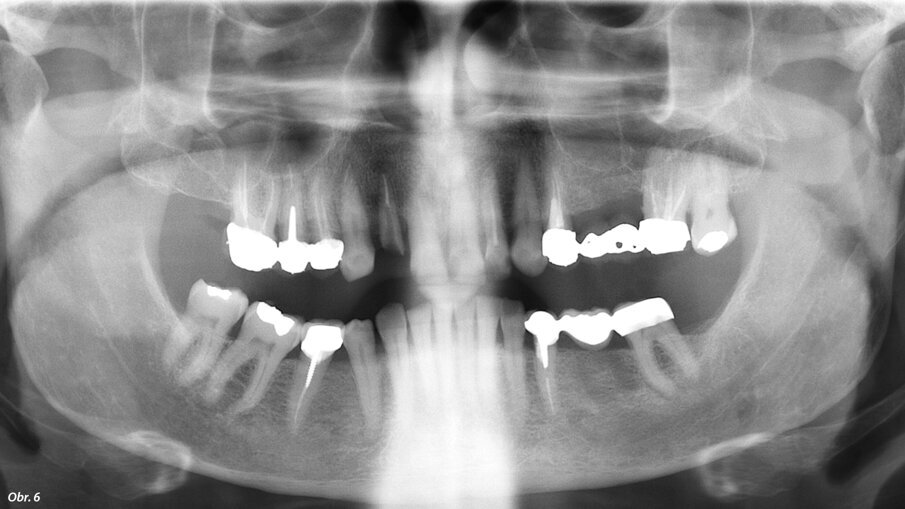 Obr. 6