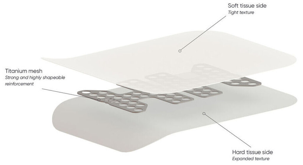 NeoGen Non-resorbable Membranes