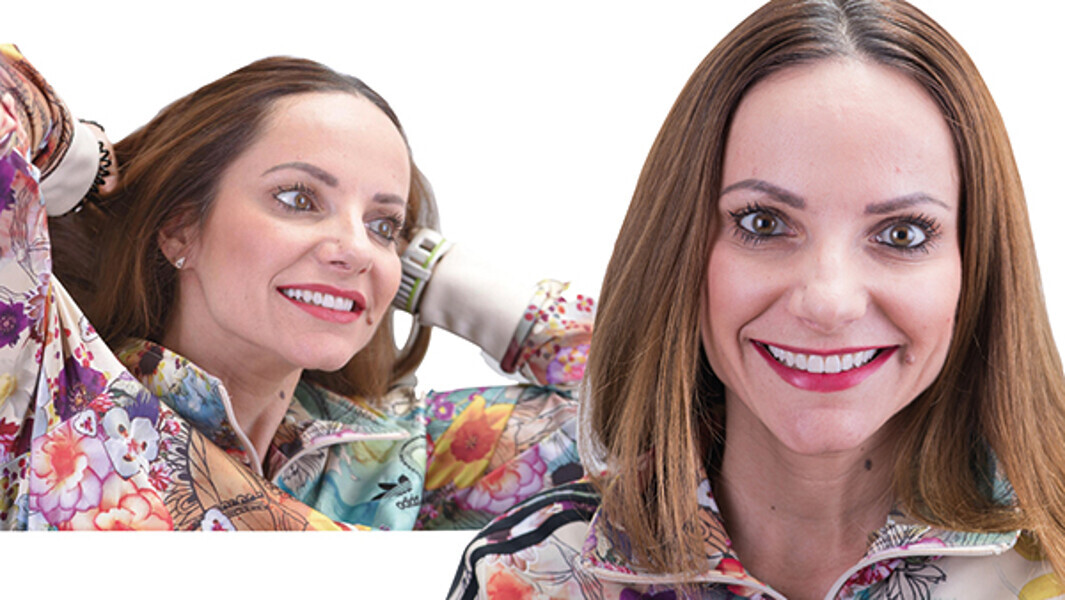 Fig. 17e. Fotografías finales extraorales.