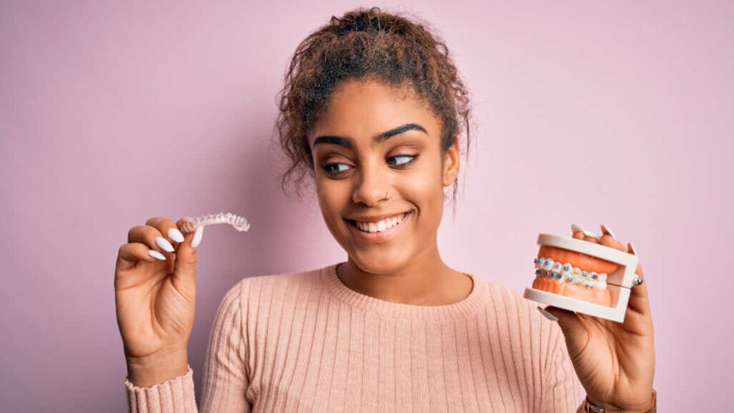 SmileDirectClub expande-se para a França