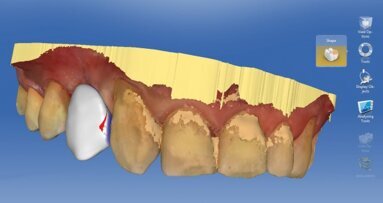 Leczenie wspomagane komputerowo z wykorzystaniem technologii CAD/CAM i CBCT