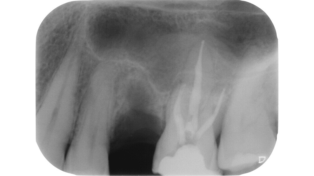 Fig. 26: Post-op radiograph.