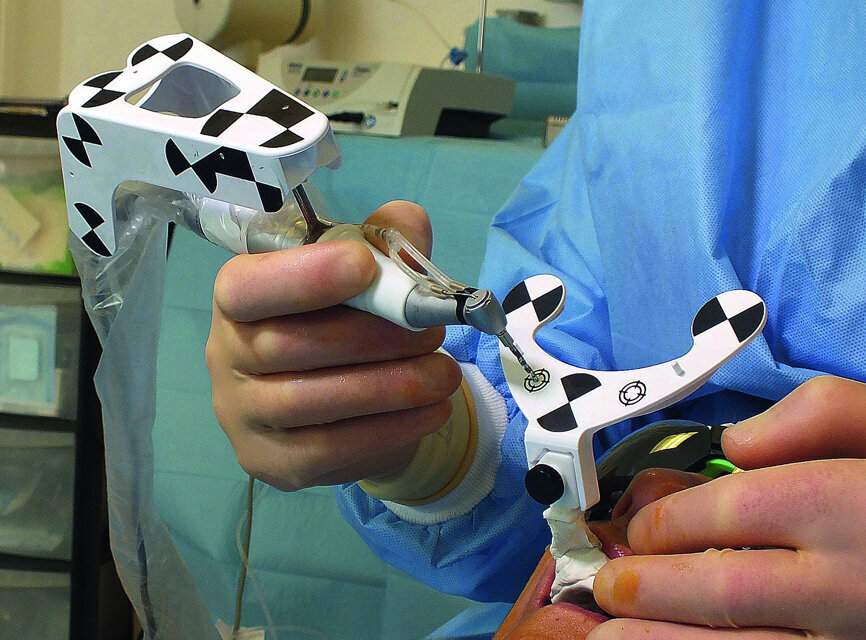 Fig. 5: Calibration of pilot drill tip.