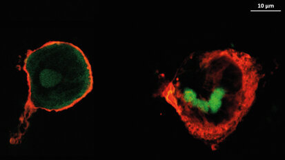 Anti-inflammatory coatings may reduce complications after dental implant surgery