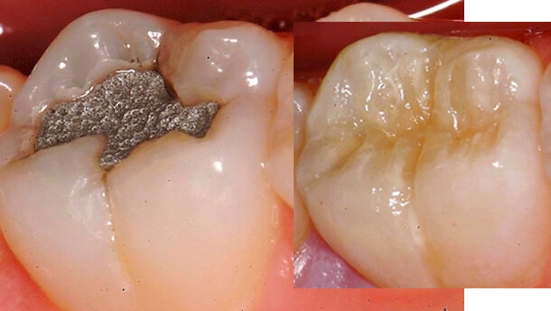 Una ilusión óptica de translucidez