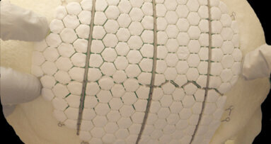 Bioceramic implant induces cranial regrowth and restores bone defects in oral cavity