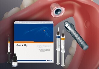 Quick Up SC Quick Up SC