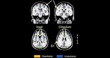 Gehirn kann Zahnschmerz kaum lokalisieren