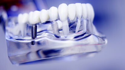 The transparent gingiva project IV