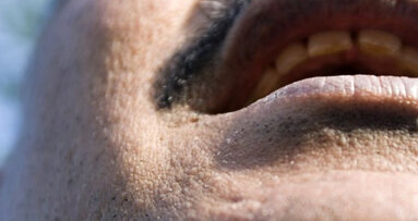 Dentists may be facing bigger in Pakistan in war against oral cancer