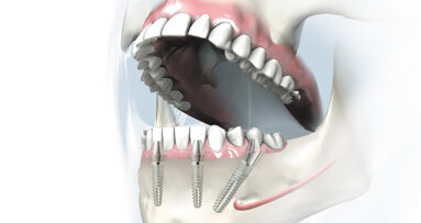 9. Unnaer Implantologietage