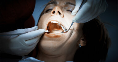 Study points to possible alternative to amalgam