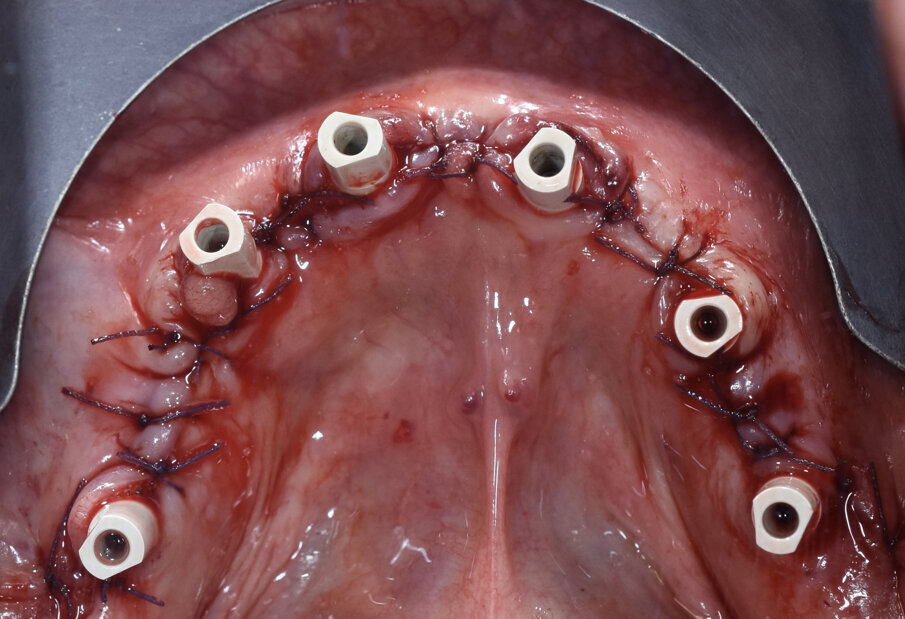 Fig. 10 - Visione occlusale.