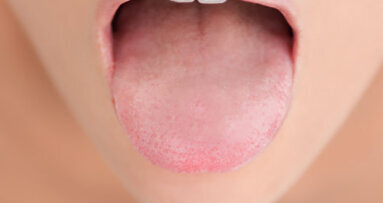 Η ξηροστομία αντικείμενο συζήτησης στο φόρουμ υγιεινής της Μεγάλης Βρετανίας