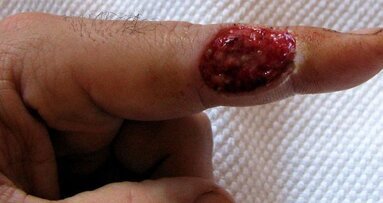 Biomateriał nowej generacji nagrodzony na wystawie innowacji