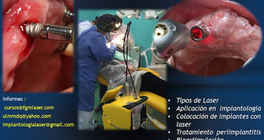 Curso de Láser en Implantología