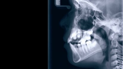 Die Bedeutung des Kiefergelenkes