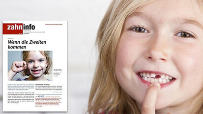 Zahninfo widmet sich dem Thema Wechselgebiss Zahninfo widmet sich dem Thema Wechselgebiss