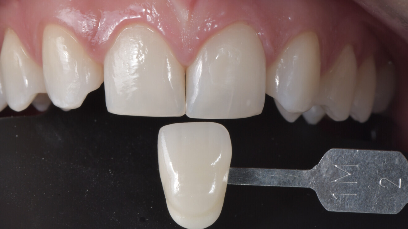 Fig.  6 : Relevé de couleur final (1M2).