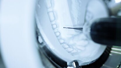 Les derniers développements dans le secteur européen des dispositifs CFAO