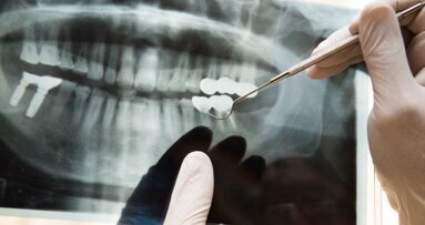 Mondzorg strenger gecontroleerd op regels röntgenfoto’s