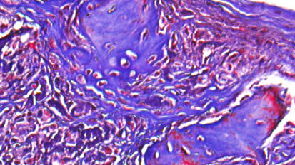 New hydrogel shows promise in dental and craniofacial tissue engineering New hydrogel shows promise in dental and craniofacial tissue engineering