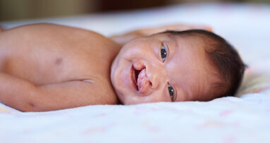 Nghiên cứu tìm ra dị tật sứt môi là do gen và môi trường