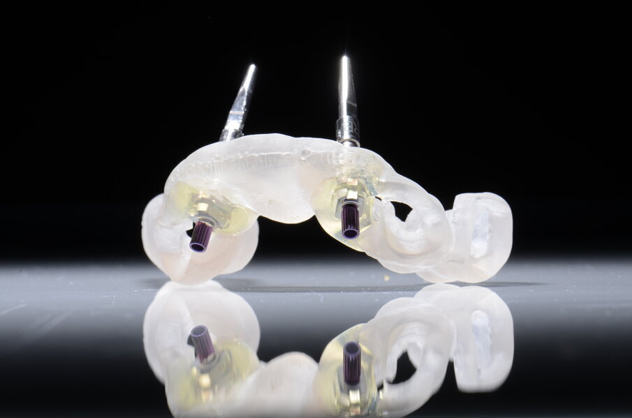 Fig. 37 - Dima protesica e transfert bloccati.