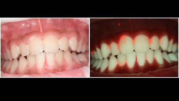 Crowdfunding voor plakcamera