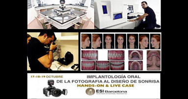 Curso de fotografía digital - diseño de la sonrisa