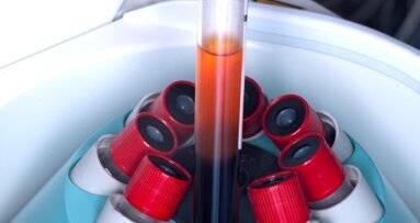 Możliwości zastosowania PRP i PRF w sterowanej regeneracji tkanek w chirurgii stomatologicznej