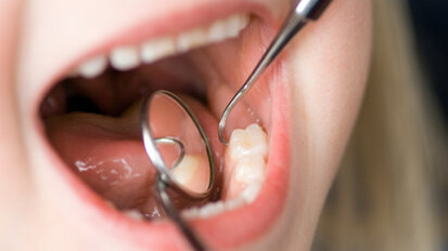 Studie belegt Wirksamkeit der parodontalen Prophylaxe