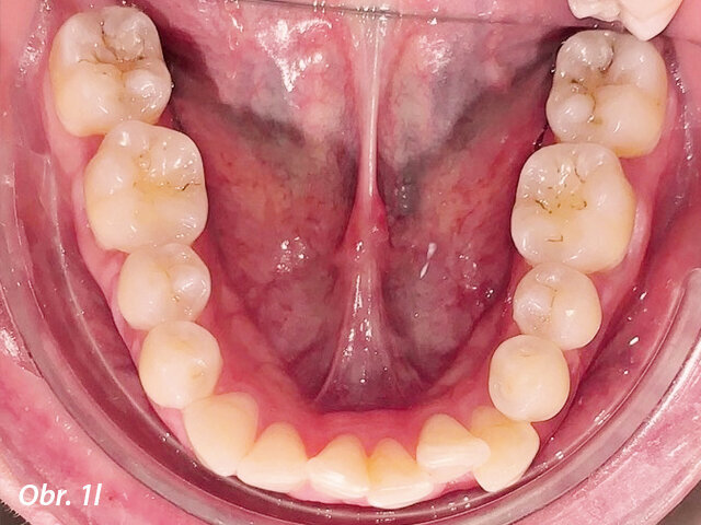 Pacientka 1 – Počáteční fotografie.