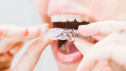 Cursos sobre alineadores dentales