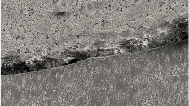 El sellado del complejo dentinopulpar (Primera parte)