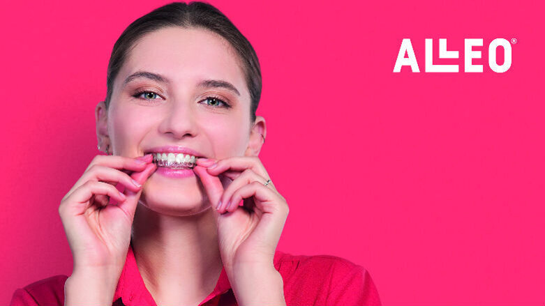 ALLEO - Arrivano i complici del sorriso!