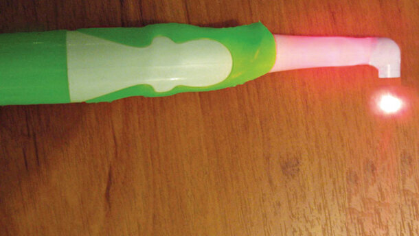 Soulagement de la douleur associée à la stomatite aphteuse récidivante