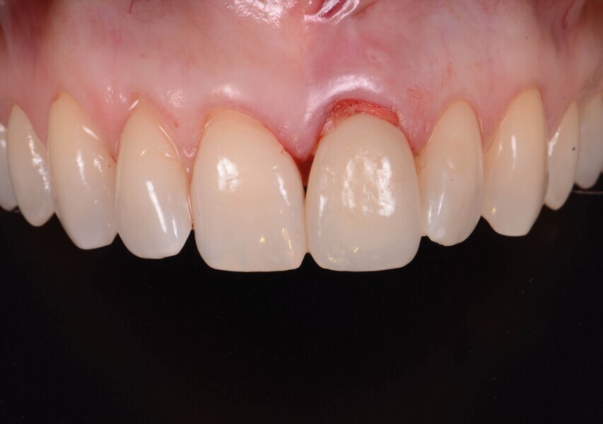 Fig. 7b : Vue occlusale.