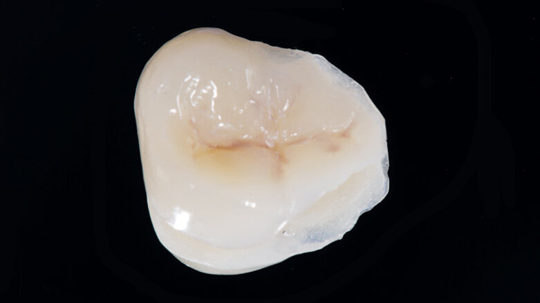 Funkční, anatomická a estetická harmonie s novým kompozitem Enamel Plus HRi Bio Function