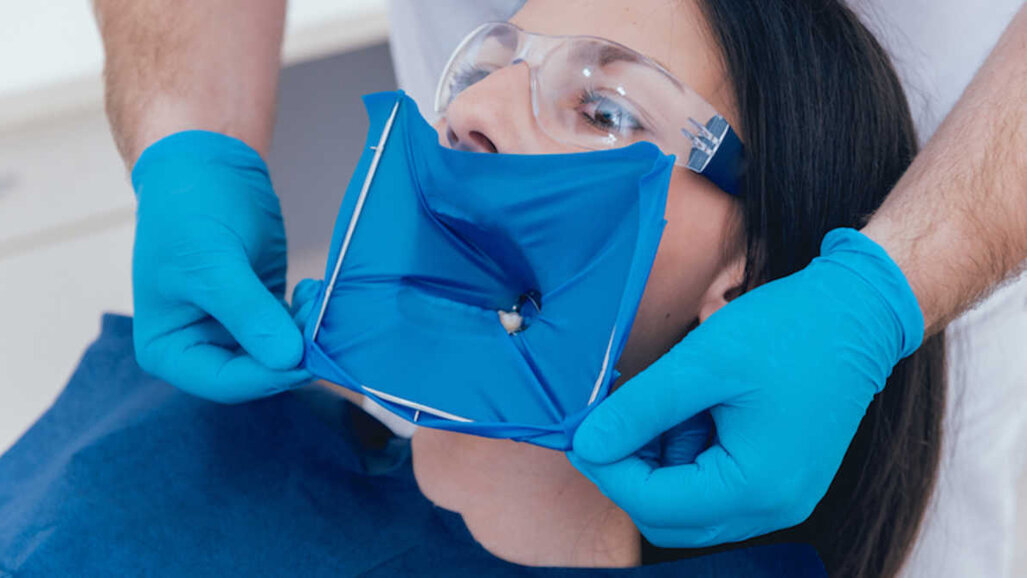 Metaanaliza je pokazala, da so potrebni dodatni dokazi o učinkovitosti izolacije s koferdami