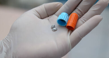 Per la difesa dell’ambiente separatori di amalgama obbligatori dal 1 gennaio