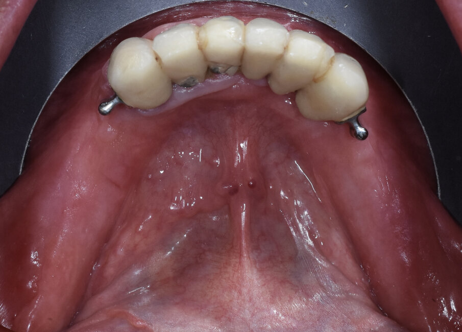 Fig. 3 - Visione occlusale.