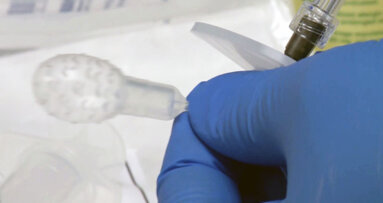 New FDA-approved device will help detect Barrett’s esophagus