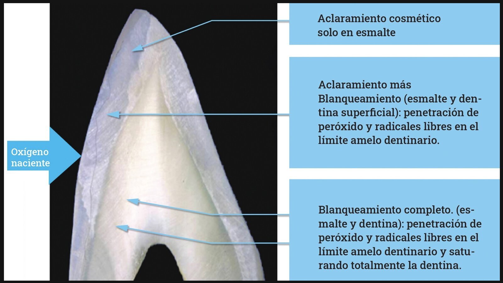 Estética y blanqueamiento dental en la era digital  (Capítulo 9)