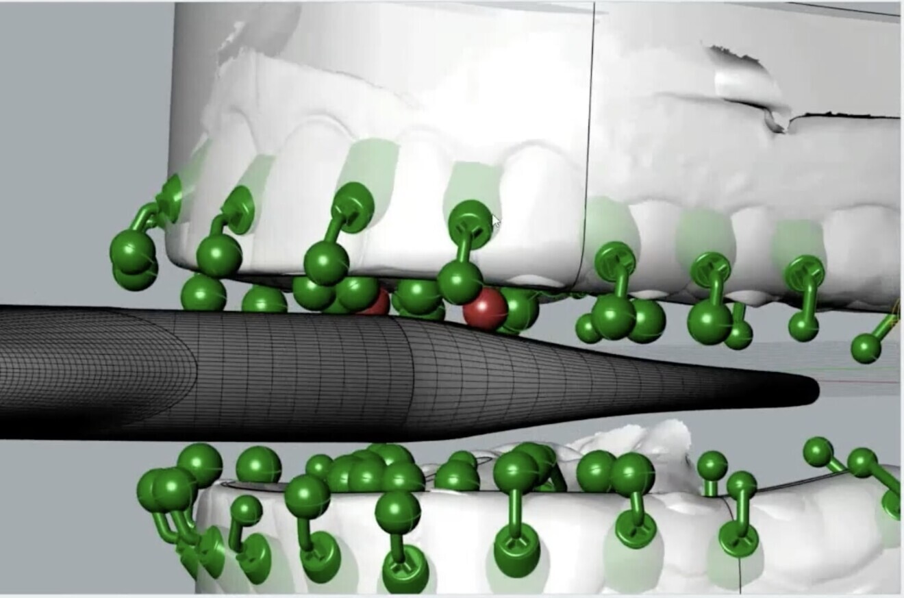 Fig. 2: Proclaim mouthpiece design, particularly the positioning of the nozzles.