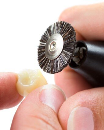 Fig. 7: Polishing of a n!ce restoration.