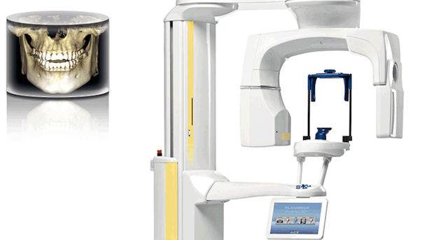 Una nueva era en imágenes dentales