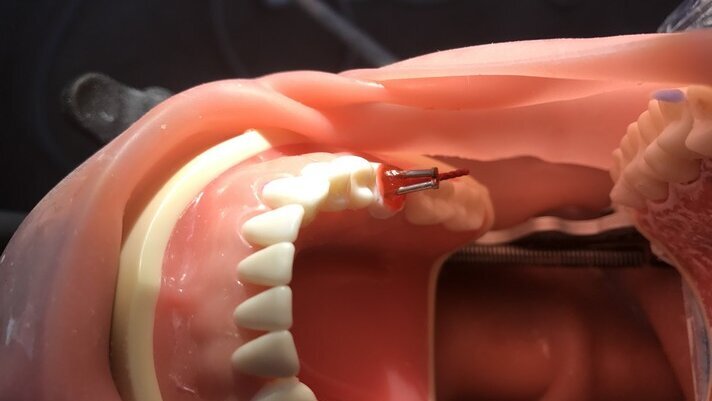 Prof. Paul Tipton: Root Filled Teeth – Practical Restoration Concepts. Hands-on course