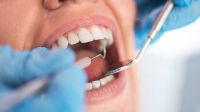 Surprising dental health inequalities found between foreign‐ and UK‐born adults